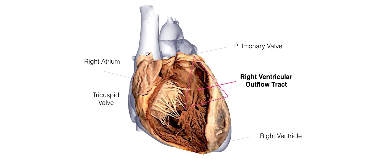 A dissection view of the heart showing the valves in the lower chambers.