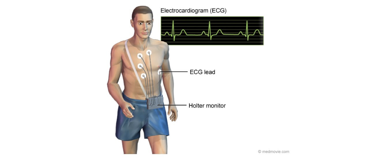The image illustrates the ECG procedure and its reading.