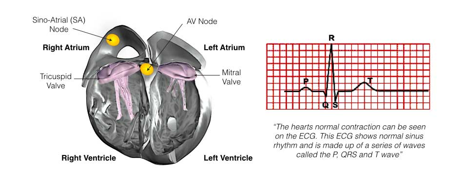 The image shows the internal structure of a heart with the SA and AV nodes with ECG readings.