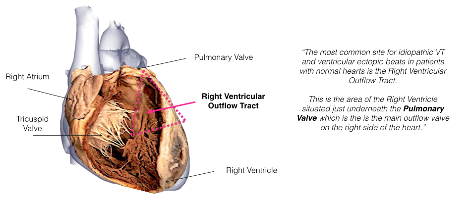 A dissection view of the heart showing the valves in the lower chambers with the right ventricular outflow tract.