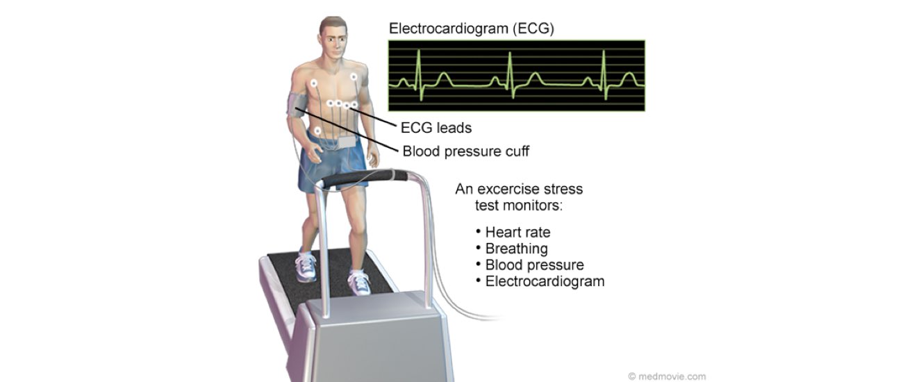 The image illustrates an exercise stress test with ECG reading.