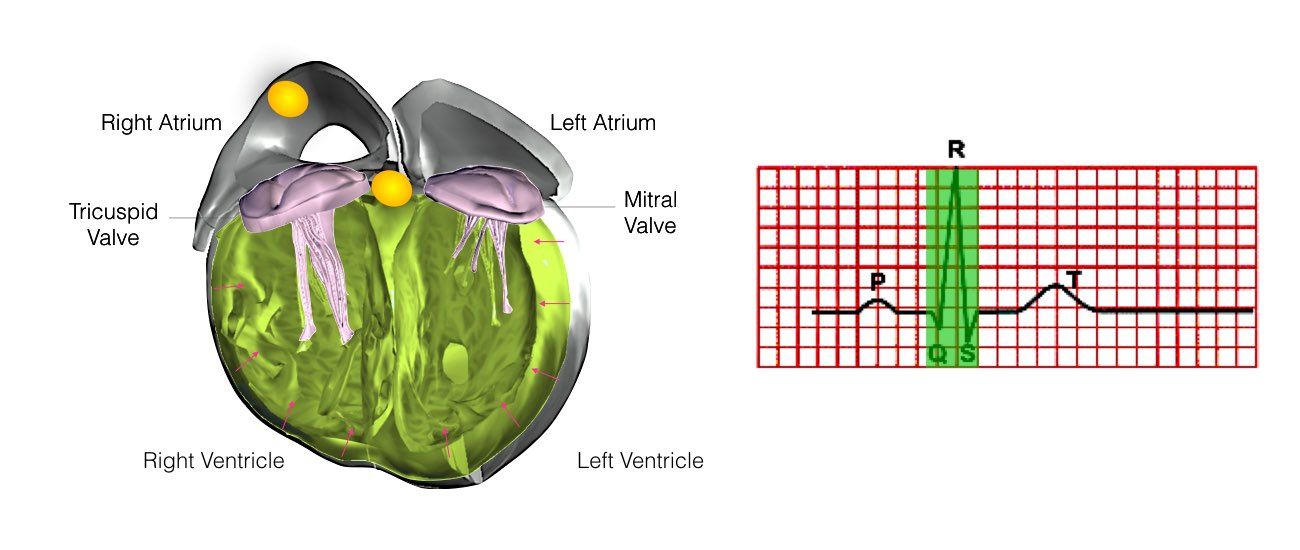 The image shows the internal heart structure at the contraction of the lower chambers with ECG reading.
