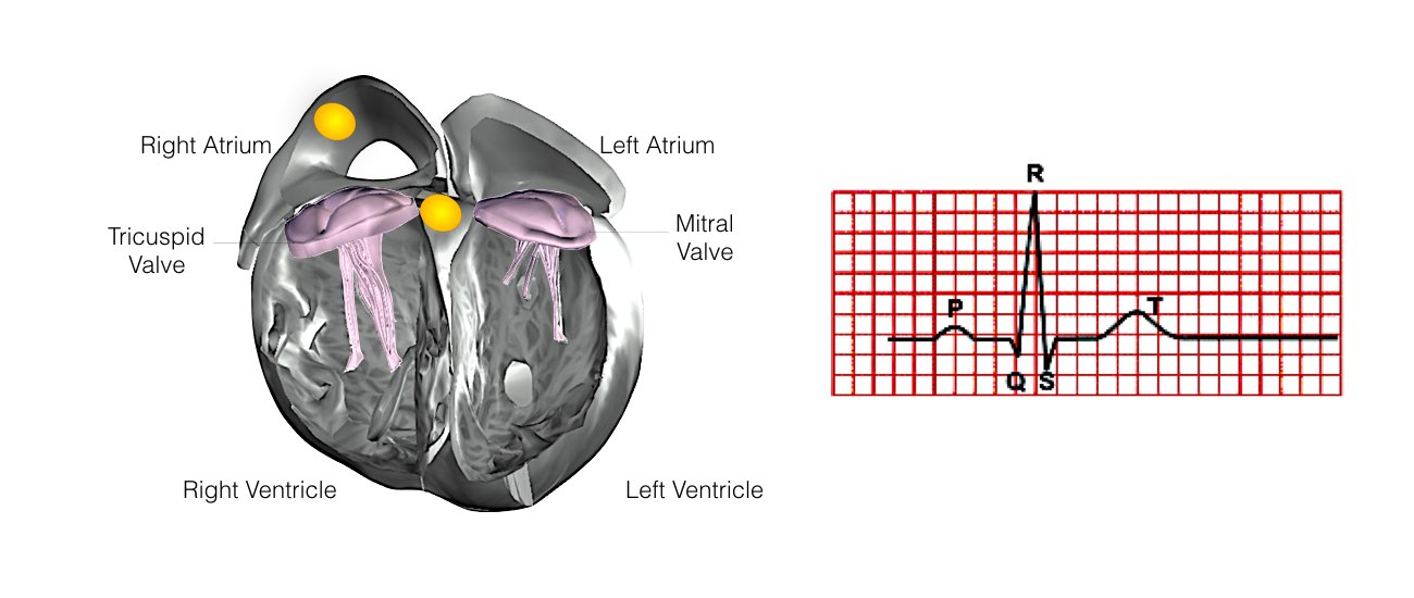 The internal structure of a heart shows the SA and AV nodes with ECG reading.
