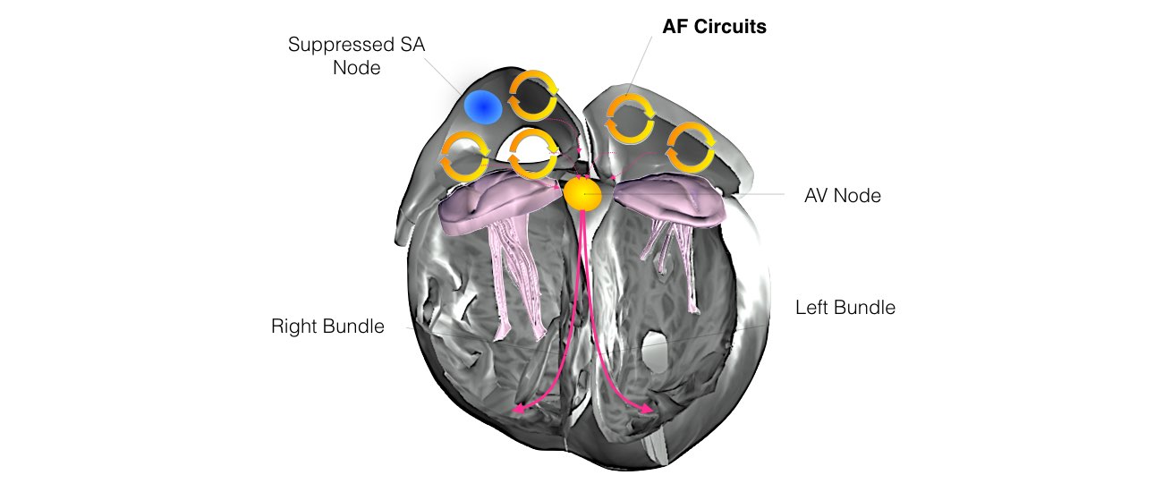 The image showing multiple short circuits in the upper chambers of the heart.